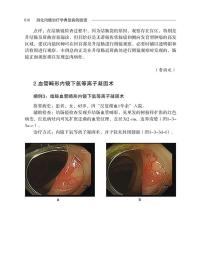 新华正版 消化内镜治疗学典型病例图谱 陈磊 柏健鹰 刘爱民 丁震 9787518980208 科学技术文献出版社 2021-09-01