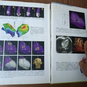 临床心律失常与电生理学：《Braunwald心脏病学》姊妹卷