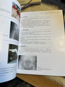 小儿骨科手术学 第2版