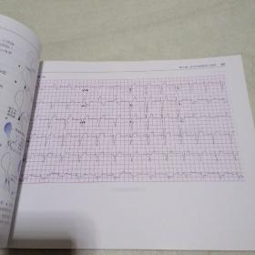 急诊心电图快速解读：心电图视觉记忆指南