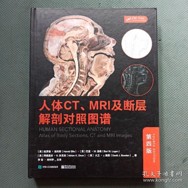 人体CT、MRI及断层解剖对照图谱（第四版）