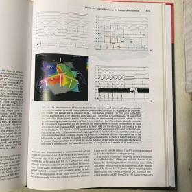 临床诊断 Clinical cardiac elrctrohysiology techniqurs and intetptetations