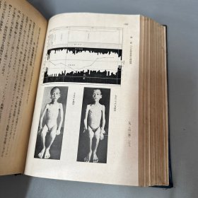 儿科杂志  昭和三年1928年日本小儿科学会（自然老化黄斑.脊梁上下破损 下缘破损 边口污渍 品相不好 看图介意勿拍）