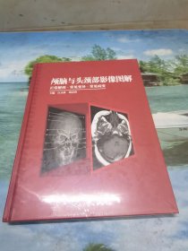 顱腦與頭頸部影像圖解正常解剖.常見變異.常見病變