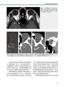 内镜眼眶外科学 解剖学基础、病理学和治疗