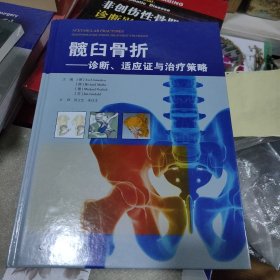 髋臼骨折——诊断、适应证与治疗策略