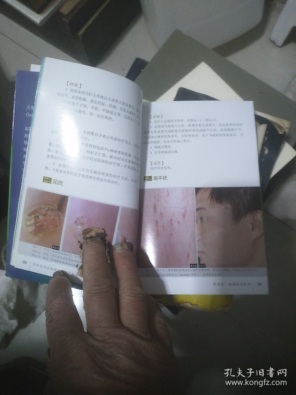 临床实用皮肤病性病诊疗图谱（第2版）