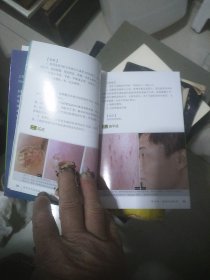 临床实用皮肤病性病诊疗图谱（第2版）