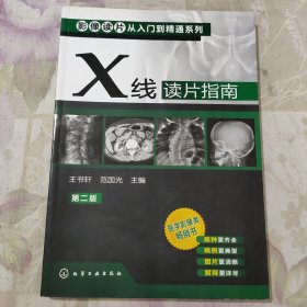 影像读片从入门到精通系列：X线读片指南（第2版）