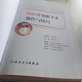 图解青光眼手术操作与技巧