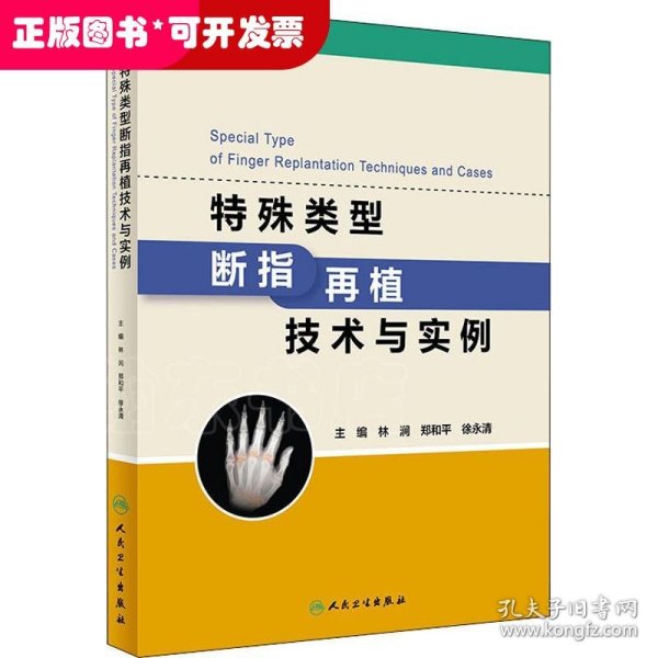特殊类型断指再植技术与实例