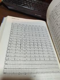 正版18导联动态心电图学（精装）