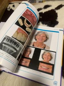 上颌无牙颌美学种植修复系统化指南