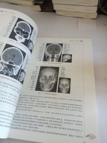 医学影像解剖学（第2版/高职影像/配增值）