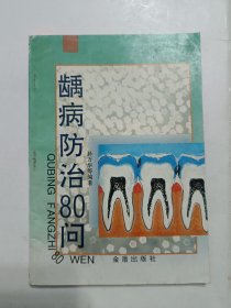 龋病防治80问