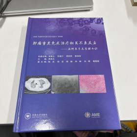 肿瘤重度免疫治疗相关不良反应——病例集萃及管理共识