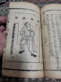 清 中医木刻本《医宗金鉴》存卷84～85 外科心法要诀 一册   内有精美版画48图  较之此书清晚版本的粗糙木刻图  有明显区别