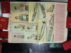1953年的彩色宣传画，(骨折及其处理)，上海新亚书店出版。