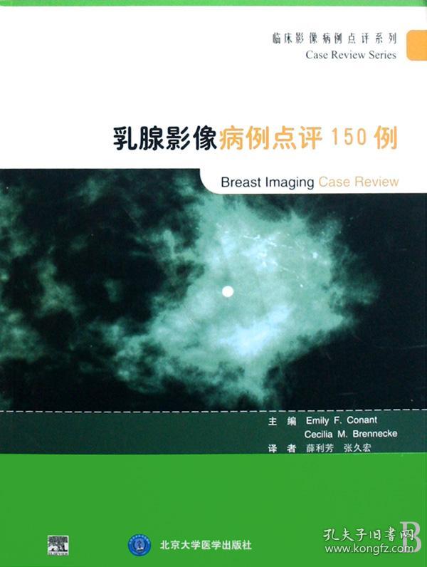 乳腺影像病例点评150例/临床影像病例点评系列