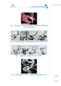 南昌大学第二附属医院神经外科病例精解