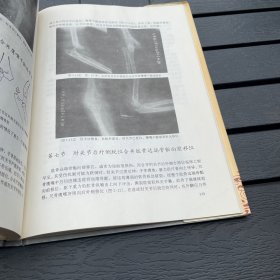 儿童肘部骨折脱位