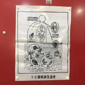 印刷品-医学教学图谱挂图（塑料）——7-2 肺吸虫生活史【29】折痕、破损