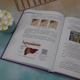 正版✔肝脏外科术中超声基础 王宏光✍本书系统介绍了肝脏外科术中超声的基本知识及临床应用，由幕内雅敏教授、刘允怡院士、董家鸿院士联合推荐，是肝脏外科医师学习术中超声的指导性工具书。正版全新书籍现货如需其他图书敬请联系客服:)