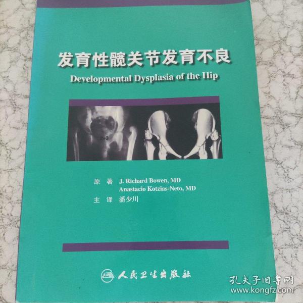 发育性髋关节发育不良  内容全新