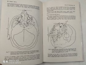 Selected topics in physics of radiotherapy and imaging