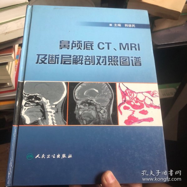 鼻颅底CT、MRI及断层解剖对照图谱