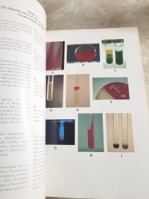 Color Atlar and Textbook of DIAGNOSTIC MICROBIOLOGY Honeman Allen Dowell Sommer J B Lippincott Company（彩色图集与教材 诊断微生物学）外文原版