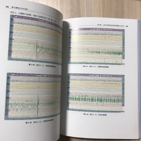 颞叶癫痫的外科问题（辽宁省优秀自然科学著作）