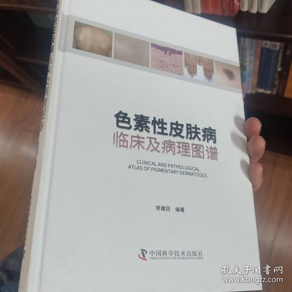 色素性皮肤病：临床及病理图谱