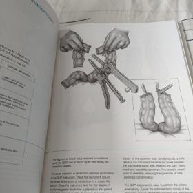 STAPLING TECHNIQUES IN GENERAL SURGERY（THIRD EDITION）普通外科手术中的吻合技术（英文原版）。