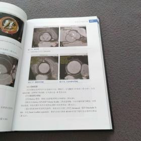 医学精萃系列--经导管主动脉瓣置换操作指南手册（签名本）