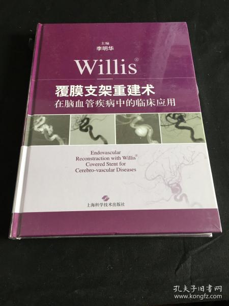 Willis覆膜支架重建术在脑血管疾病中的临床应用