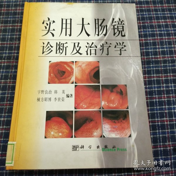 实用大肠镜诊断及治疗学