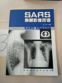 SARS胸部影像图谱(有水印)。