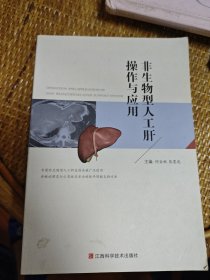 非生物型人工肝操作与应用