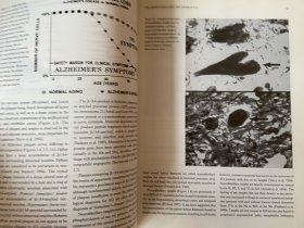 【英文原版】Memory in Neurodegenerative Disease 神经退行性疾病中的记忆