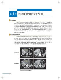 新华正版 肝胆胰外科手术实录（翻译版） 唐伟 著 9787117288170 人民卫生出版社