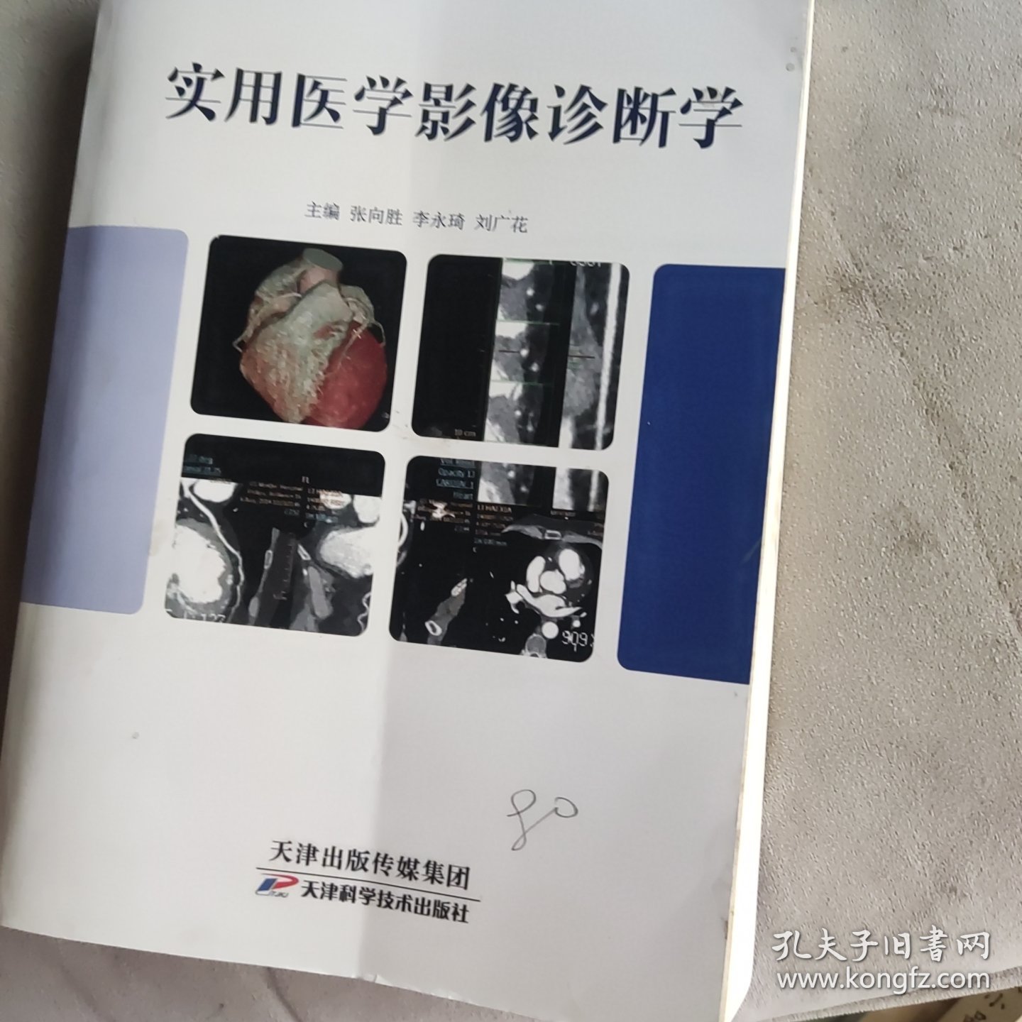 实用医学影像诊断学