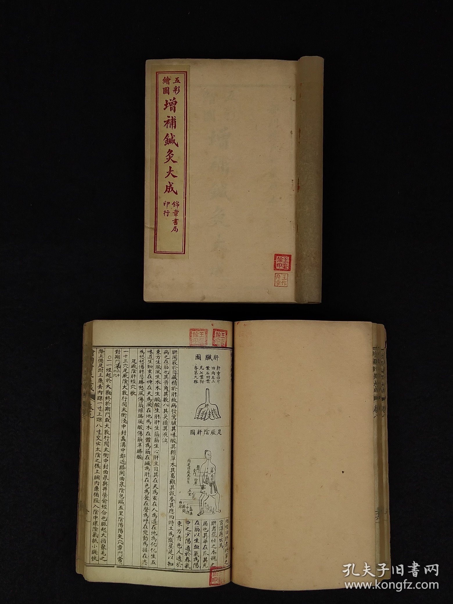 1954年上海锦章书局最后一批石印中医典籍【增补针炙大成】全套六本合订为两厚集，共十二卷，全国仅印制一千套。 本书较全面论述针灸理论、操作手法等，并考定腧穴名称和部位，记述历代名家针灸医案，对明以前针灸学术的又一总结，是学习研究针灸的重要参考著作。保存完整无缺、品相好！