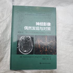 神经影像偶然发现与对策--放射科、神经外科和神经内科医生指南