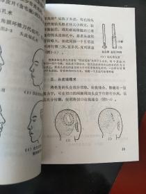 常用医学美容手术图解