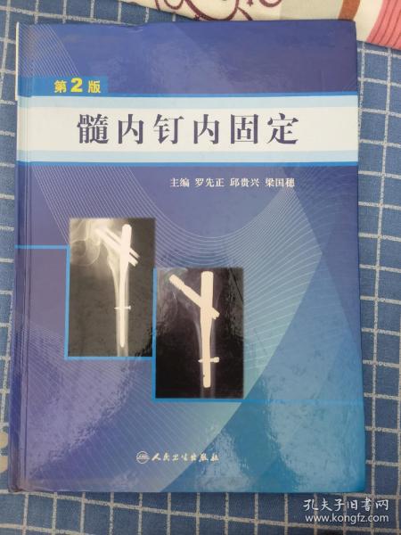 髓内钉内固定（第2版）