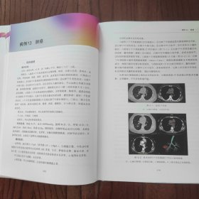 华西影像病例精解（中国临床案例）【精装本】9787543986930