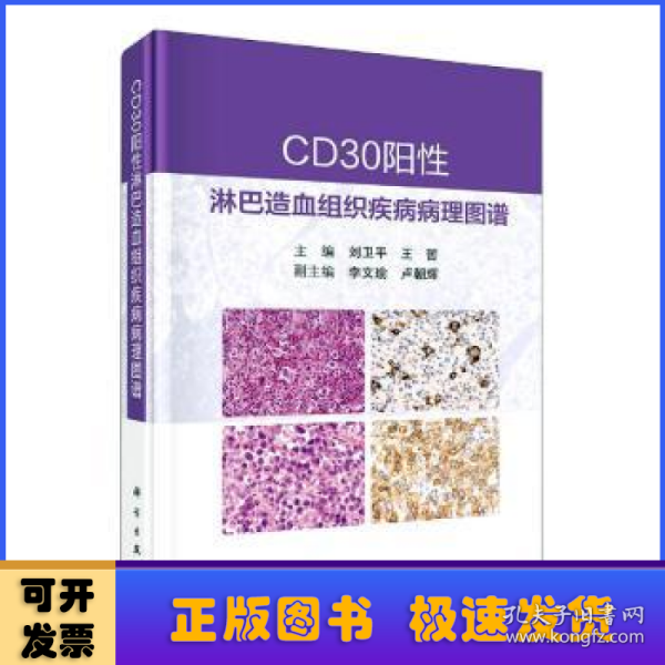 CD30阳性淋巴造血组织疾病病理图谱 刘卫平 王哲著