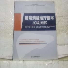 肝癌消融治疗技术实战图解