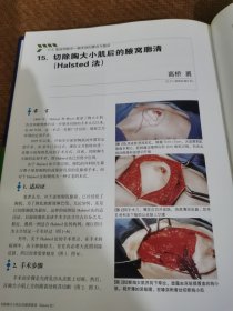 乳腺外科要点与盲点：乳腺外科要点与肓点